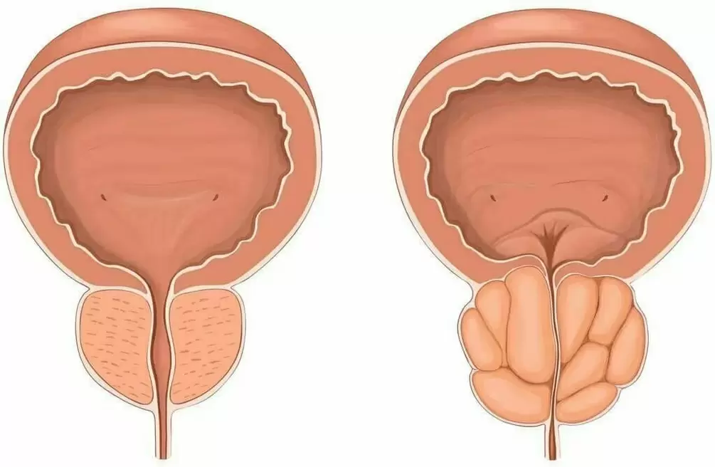 Prostata - Fares, 60 capsule (Pentru prostata) - rotl.ro