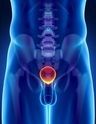 clasificarea modernă a prostatitei cronice prostatita si ganglionii limfatici